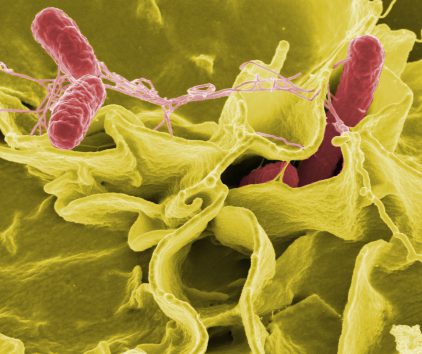 Salmonelles sur des celllules humaines Credit: Rocky Mountain Laboratories,NIAID,NIH