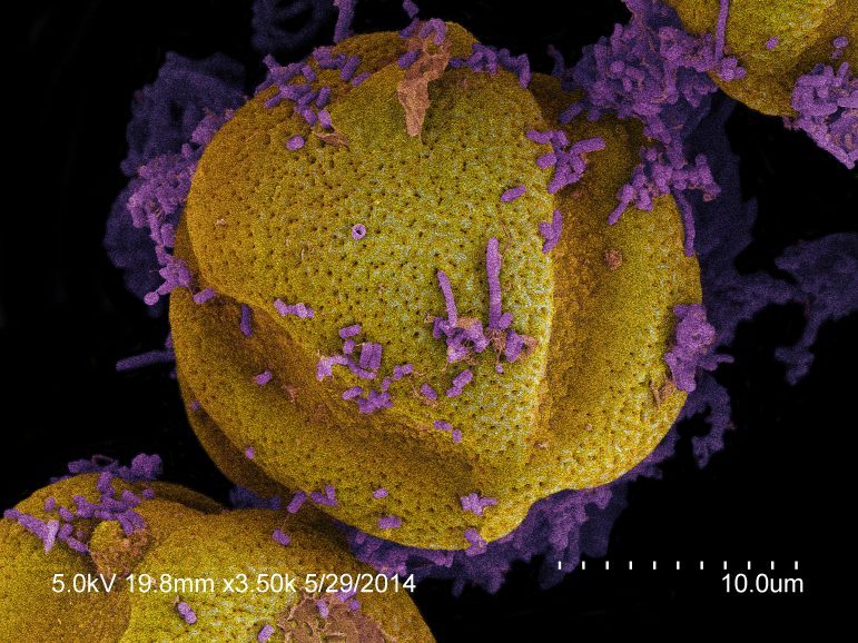 Grains de pollen (jaune) et bactéries (violettes) extraits du jabot d'une abeille à miel, Apis mellifera © ARS