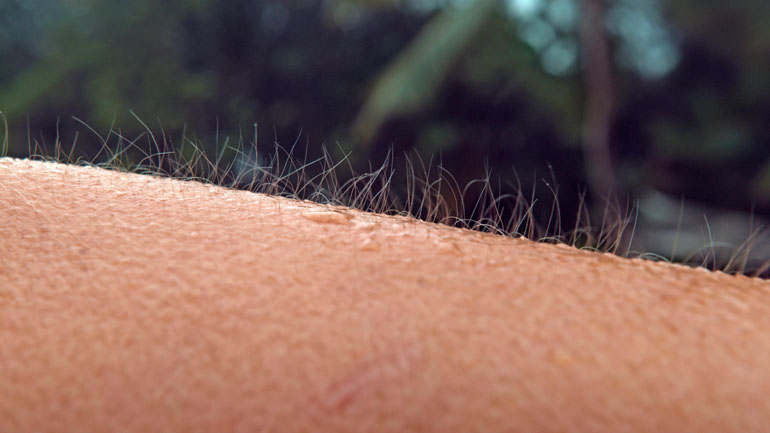 Pourquoi les poils se hérissent-ils quand on a froid ? Romane, 9 ans. -  Images Doc